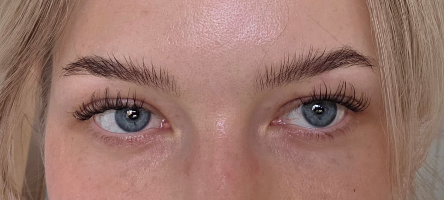 Customer photo review of THE CANCER (Krebs 5-11 mm)