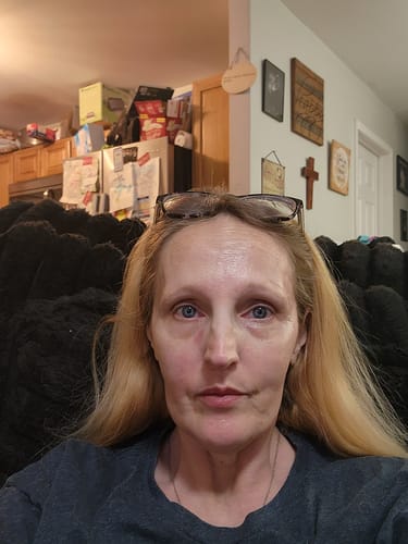 Customer photo review of HER+ Balm Monthly Refill