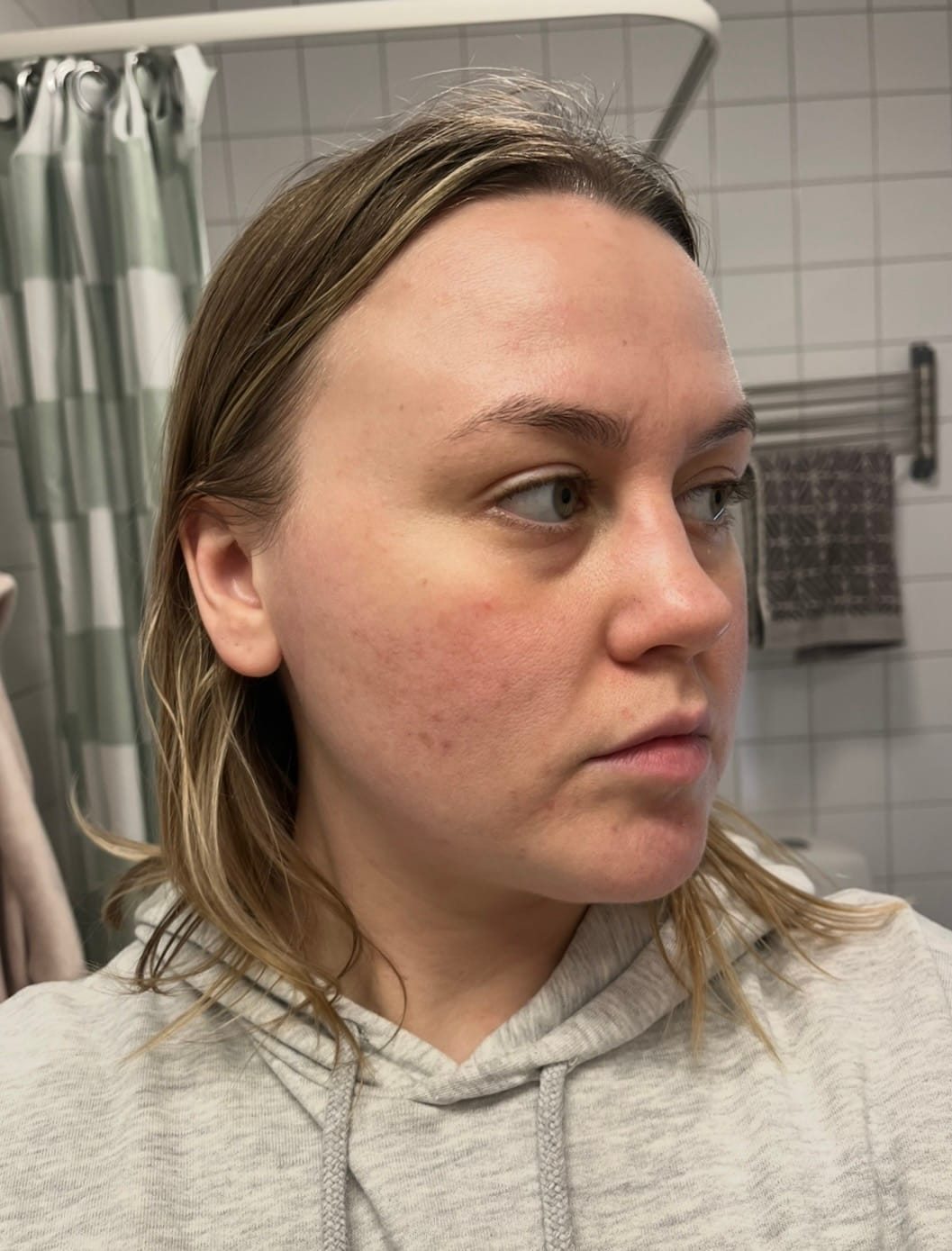 Customer photo review of Skinboosting LED mask