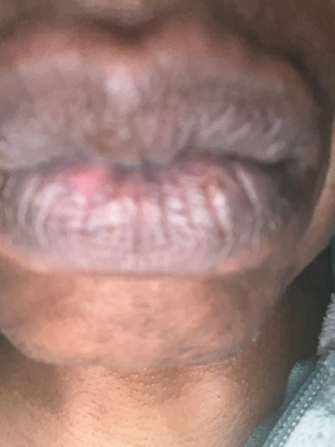 Customer photo review of Lips Lightening Cream For Men and Women (Results in 5 Days or Less)