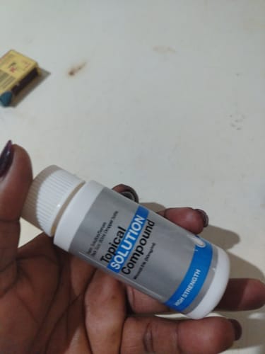 Customer photo review of Minoxidil 5% SOLUTION, 3x60ml pack