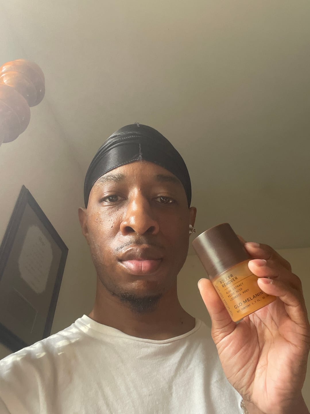 Customer photo review of Roller Remover (ingrowns and dark spots).
