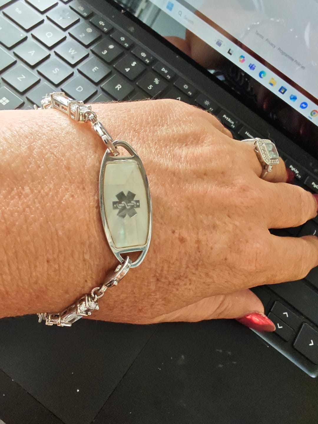 Customer photo review of Lumine Grace Women’s Medical ID Bracelet