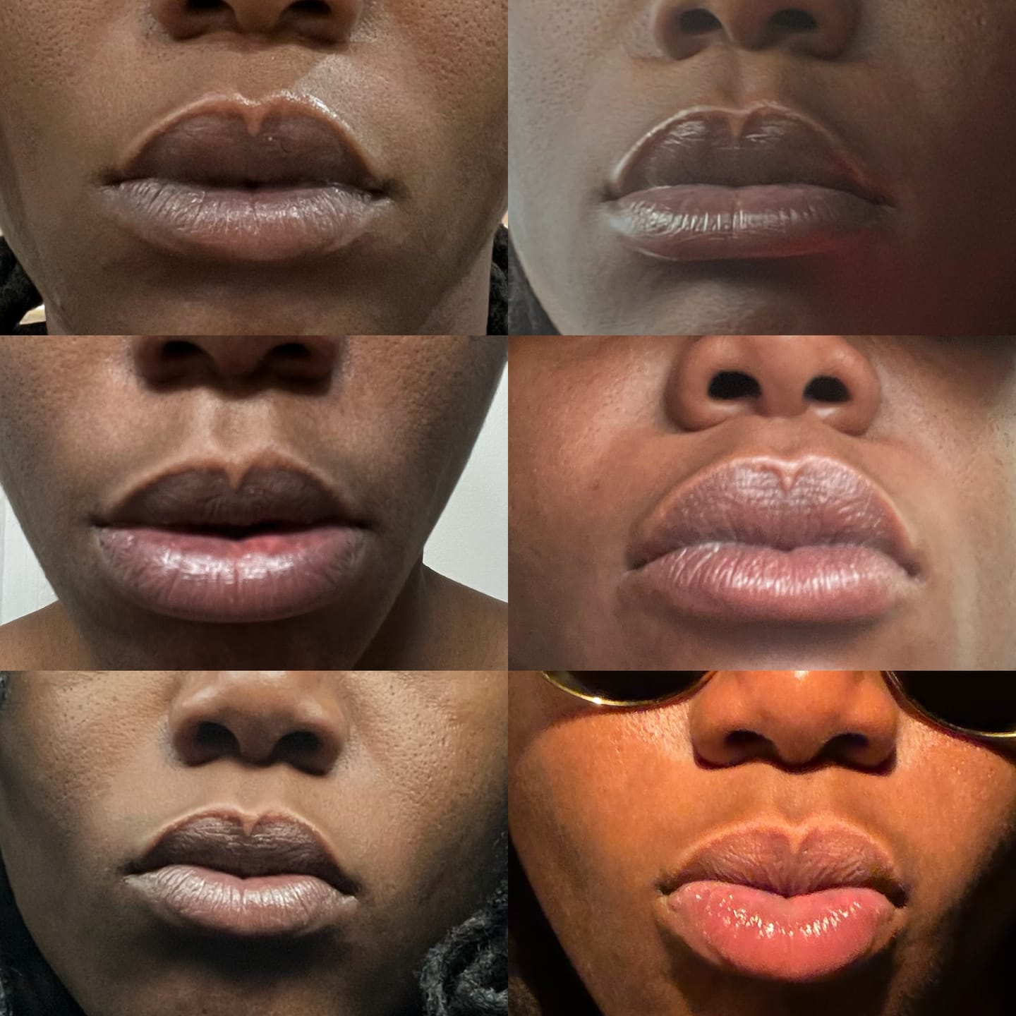 Customer photo review of Lips Lightening Cream For Men and Women (Results in 5 Days or Less)