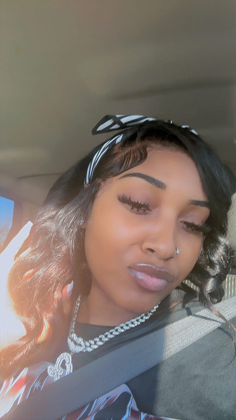 Customer photo review of Hold Me Down™ Adhesive Skin Guard (Ain’t No Other™)