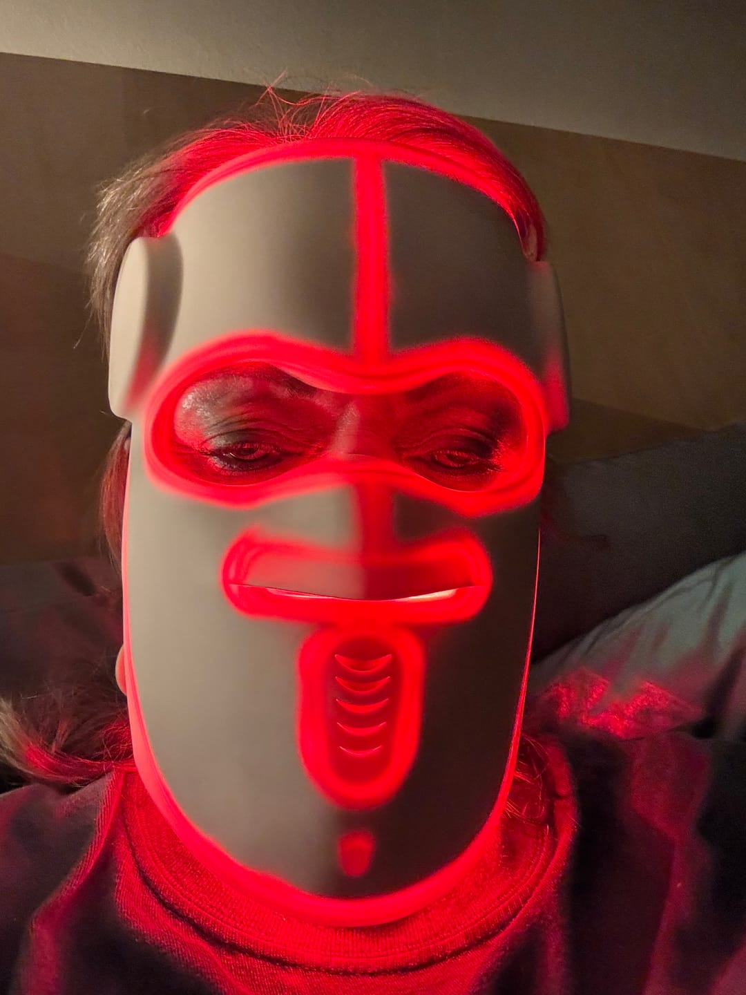 Customer photo review of Hatch Halo™ Dermatologist Grade 3-in-1 Light Therapy Mask