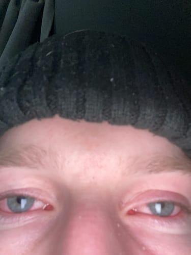 Customer photo review of Exotic THCa Shake