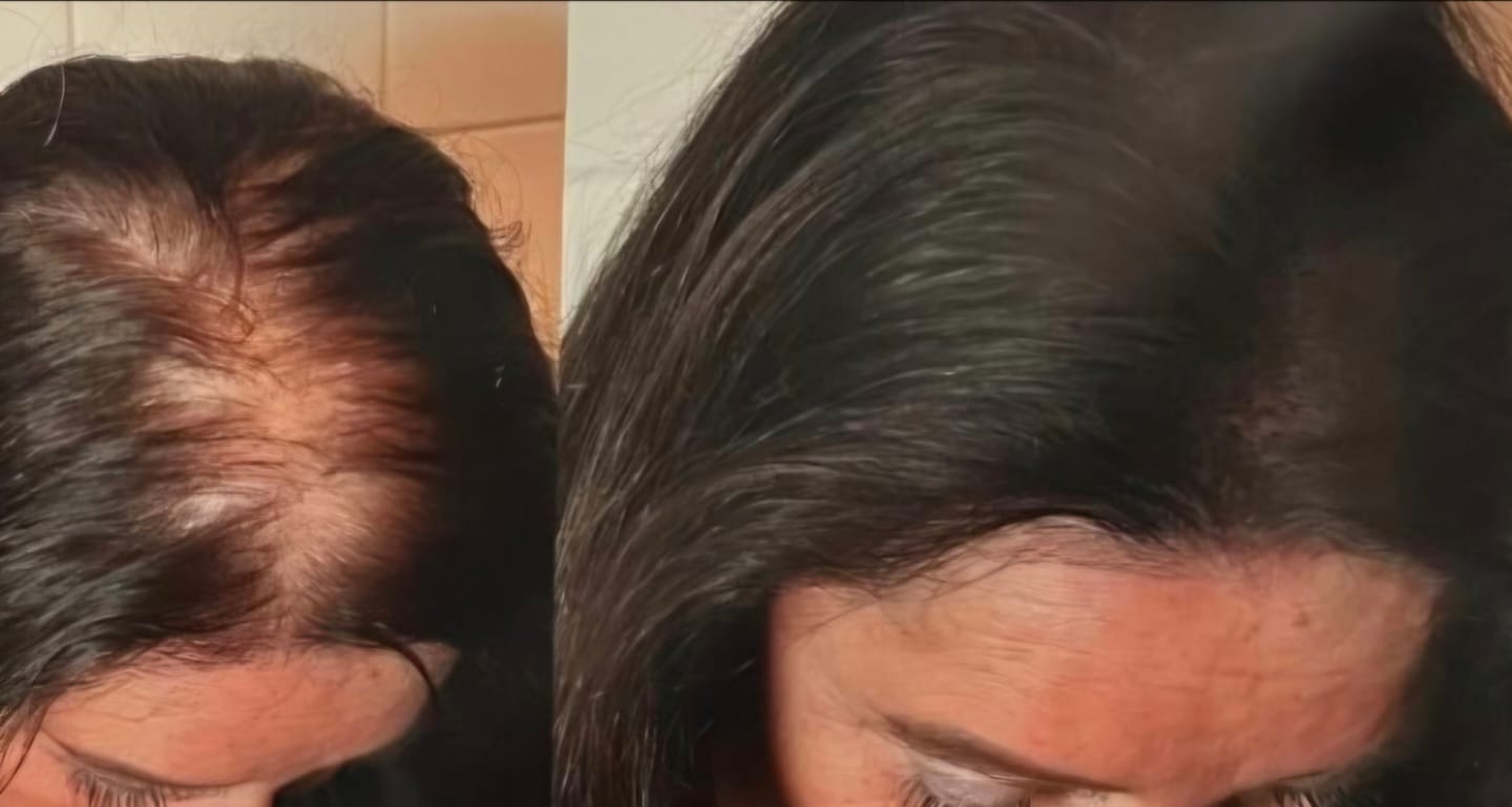 Customer photo review of BelleLux Haarconcealer