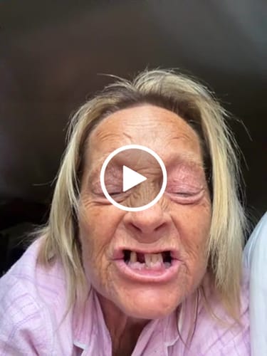 Customer video review of 🦷  Fit Full Functional DenturesMake you more confident-Made in the USA & FDA-Certified
