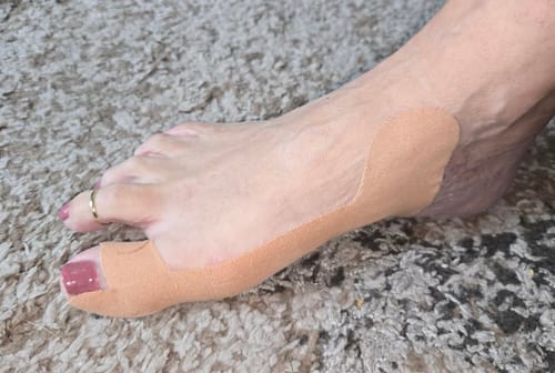Kundenbewertung mit Foto zu TAPEX™ - Hallux-Valgus