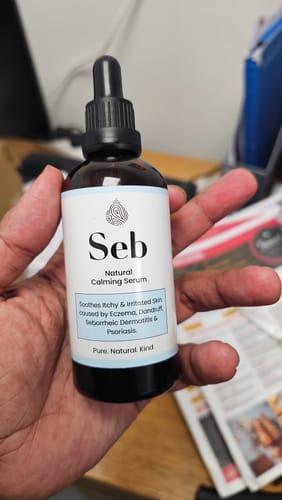 Customer photo review of Seb Natural Calming Serum