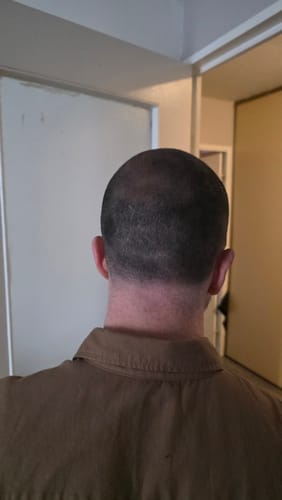 Client montrant l'arrière de sa tête avec une zone de cheveux clairsemée après avoir utilisé le camouflage capillaire.