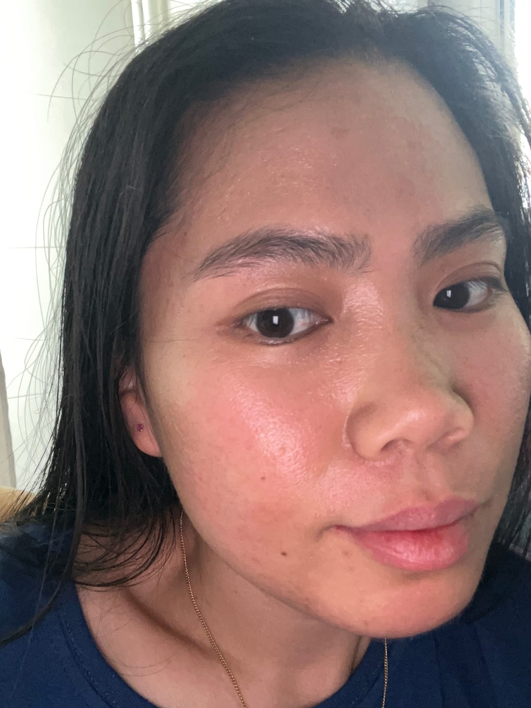 Customer photo review of Dr. Althea - Crème - 345 Relief Cream