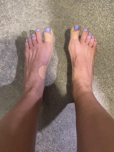 Kundenbewertung mit Foto zu TAPEX™ - Hallux-Valgus