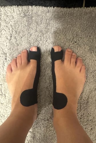 Kundenbewertung mit Foto zu TAPEX™ - Hallux-Valgus