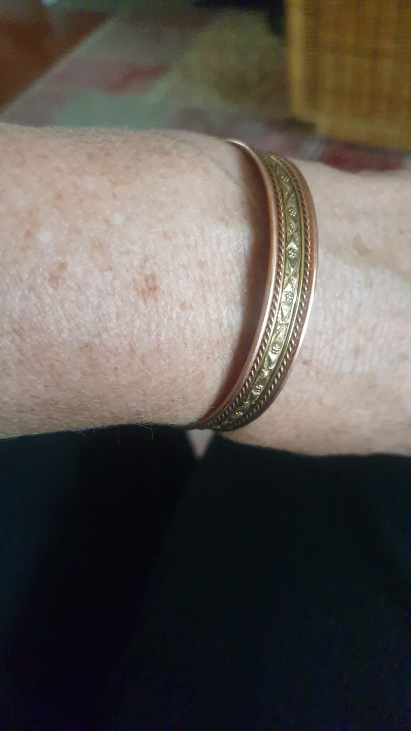 Customer photo review of Aura / Magnetic / Copper Bracelet