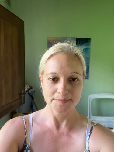 Customer photo review of The Glo Bright Serum