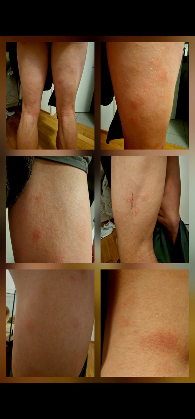 Customer photo review of Akutpflege-Set