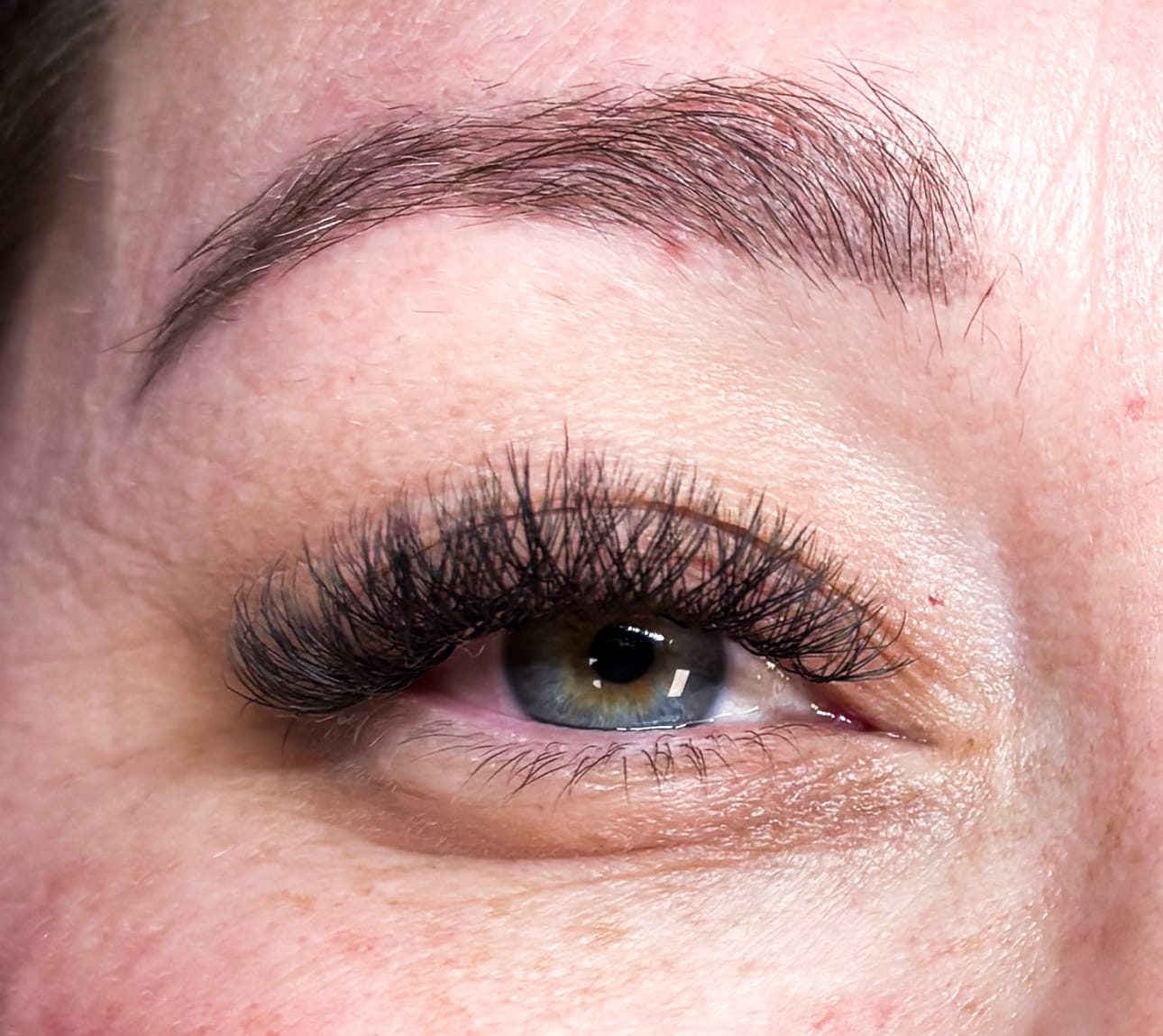 Customer photo review of 50PC Under Eye Gel Pads