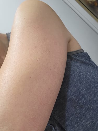 Customer photo review of Besque® Magic Body Oil - 100ml
