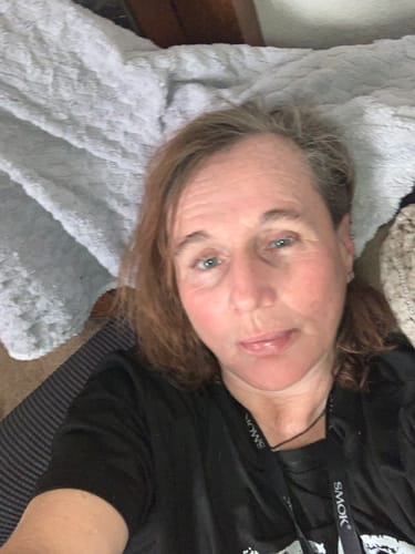 Customer photo review of Transform Wrinkles, Fine Lines, And Tired Creases Naturally