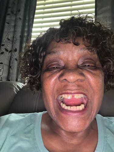 Customer photo review of Lemon Turmeric & Kojic Acid Brightening Soap Bar - Classic & Scented Options