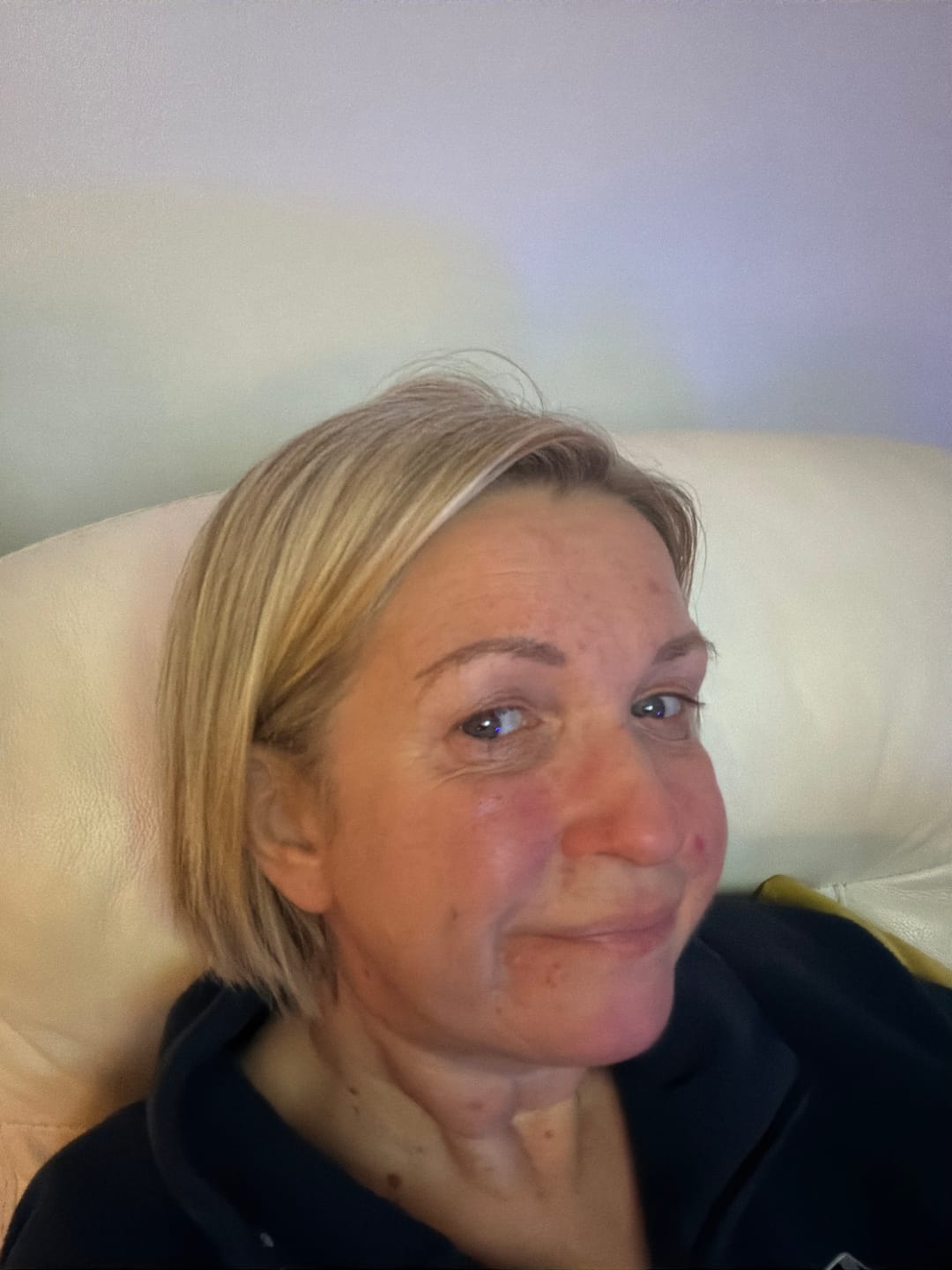 Customer photo review of Rosalique 3 in 1 Anti-Redness Miracle Formula SPF50