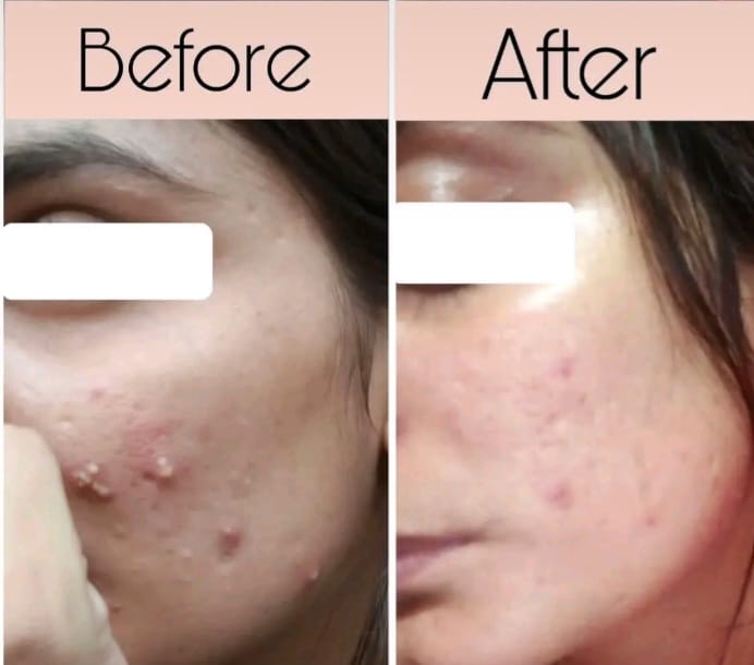 Customer photo review of Skin Rescue Mist