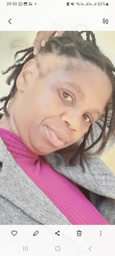 Customer photo review of Minoxidil 5% SOLUTION, 3x60ml pack