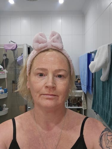 Reviewer showing their face with glowing skin after using the Seranova Micro Infusion System.