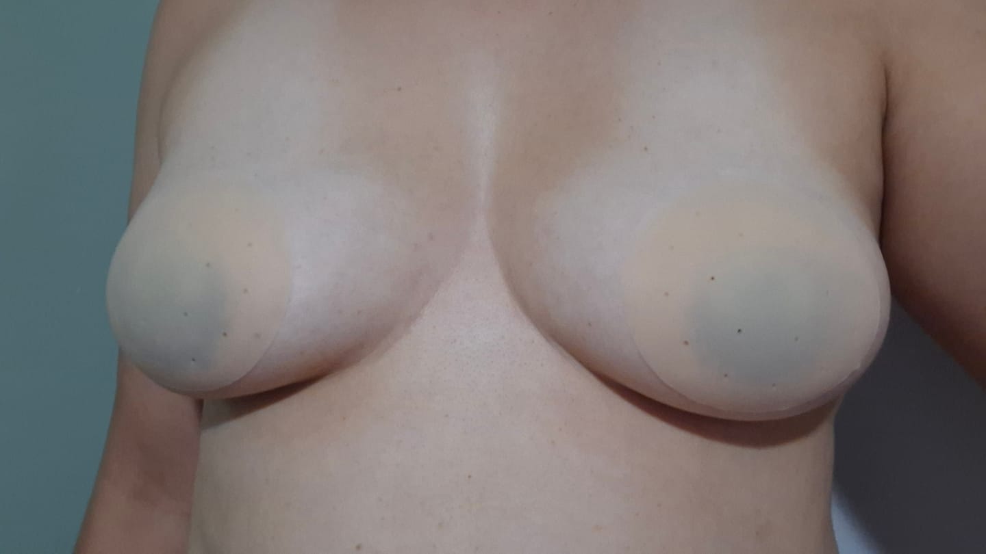 Customer photo review of Silicone Nipple Covers (Non-Adhesive)– Seamless, Reusable & Waterproof
