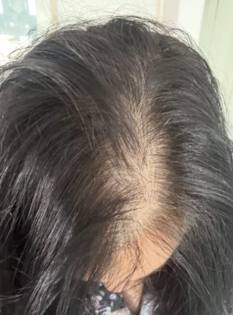 Customer photo review of Hair & Nail Capsules