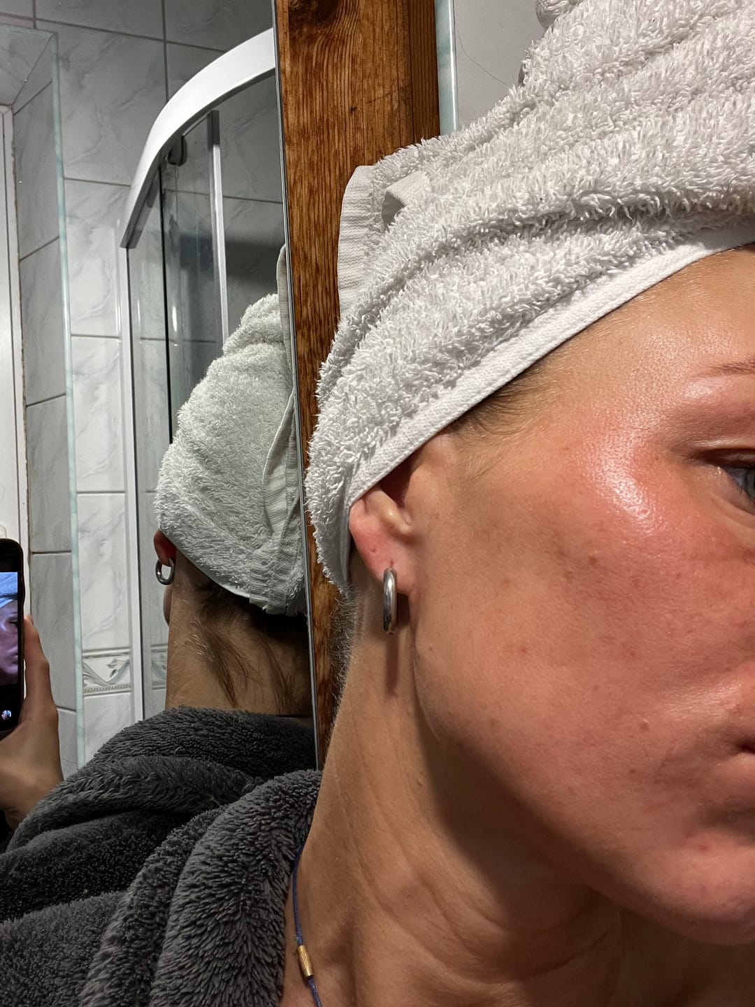 Customer photo review of Keep glowing serum 30ml