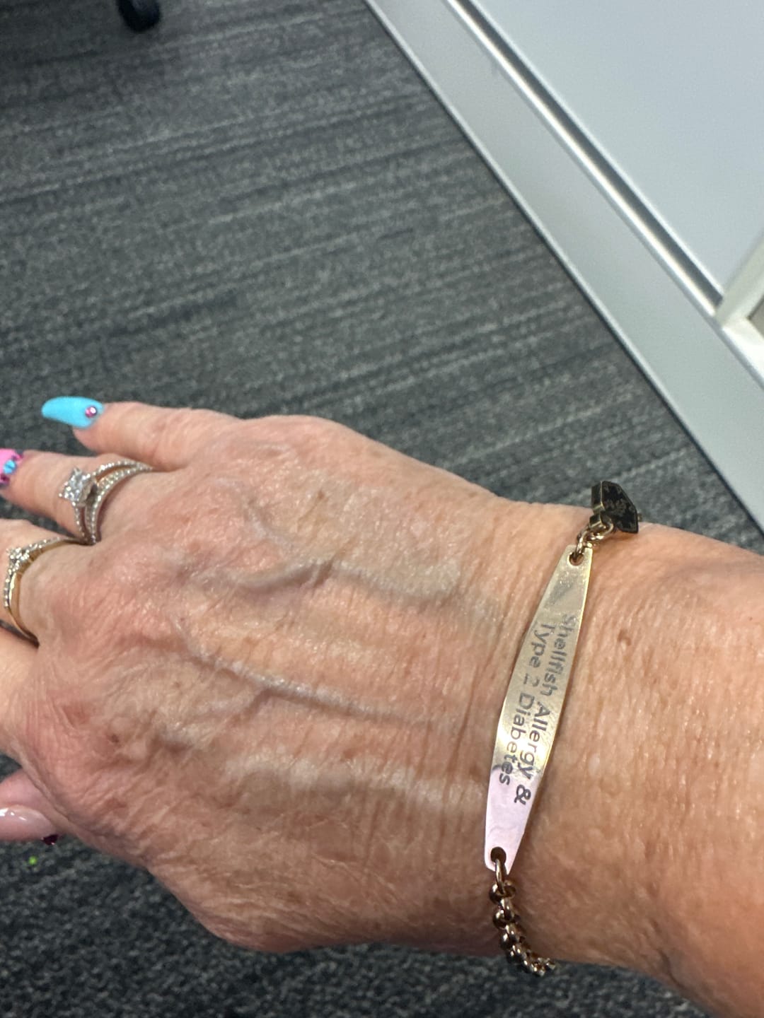 Customer photo review of Rose Gold Colour Medical Alert Bracelet with Medical Charm