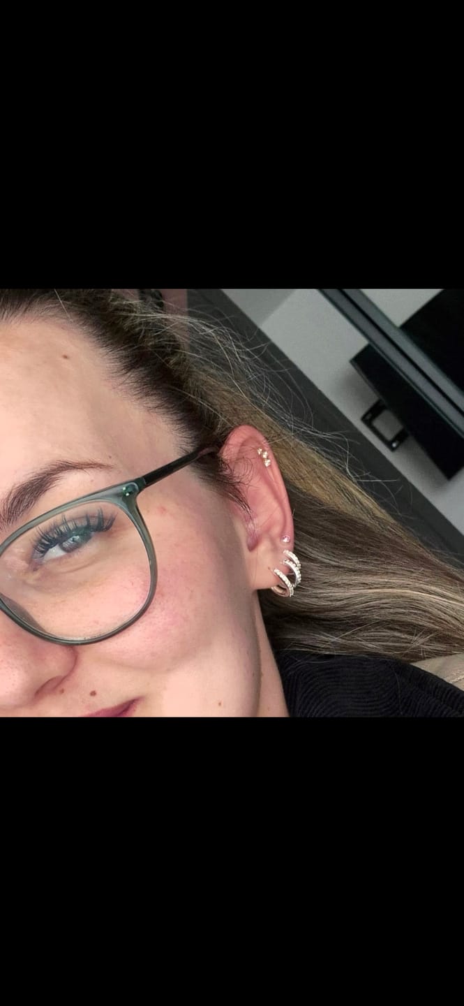 Customer photo review of NO FILTER STARTER KIT (12mm-14mm)