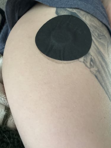 Customer photo review of Skin Grip MAX Dexcom G7 & Stelo Patches - 10 Pack