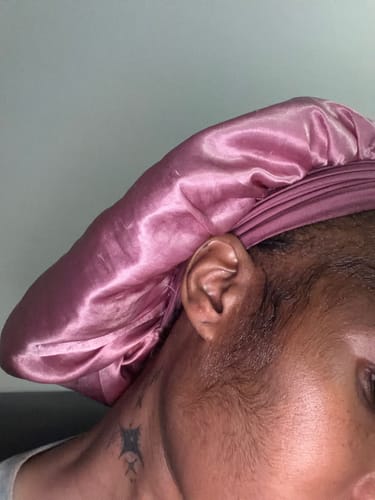 Customer photo review of Minoxidil5% Solution, 1 Pack 60ml