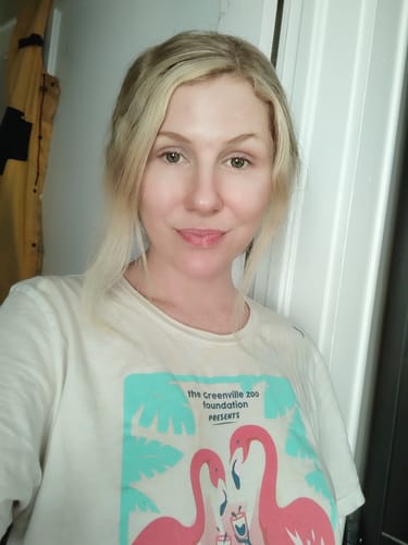 Reviewer showing smooth skin on her face after using the Seranova Micro Infusion System.