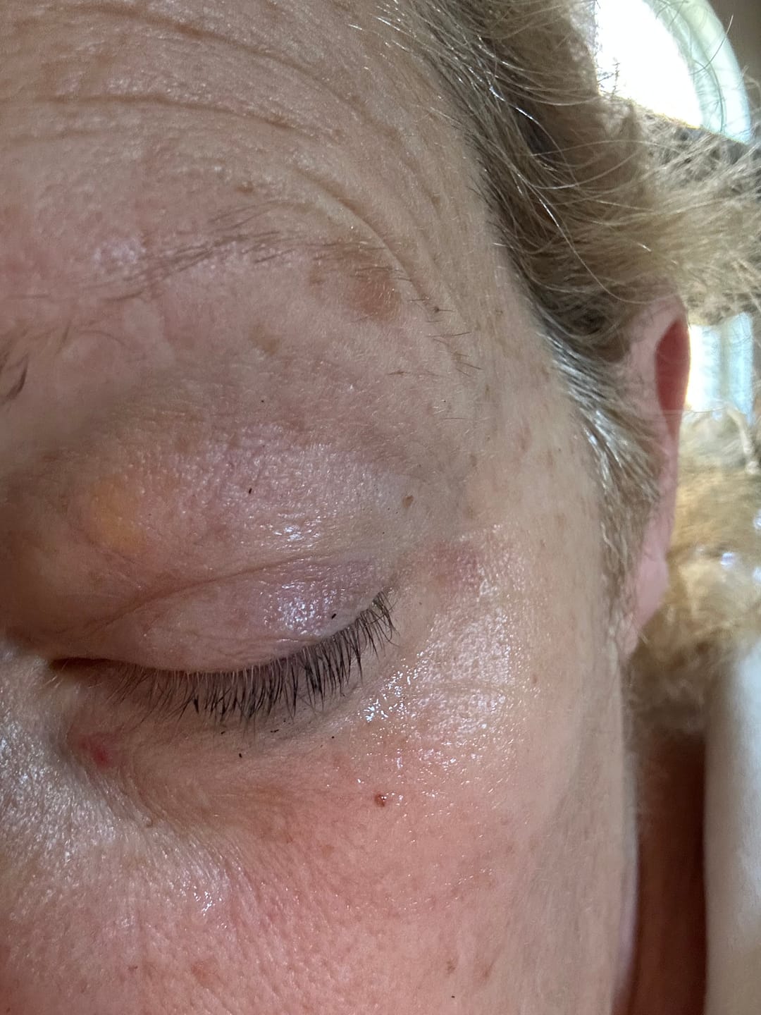 Customer photo review of Vitamin C Kelp Eye Gel
