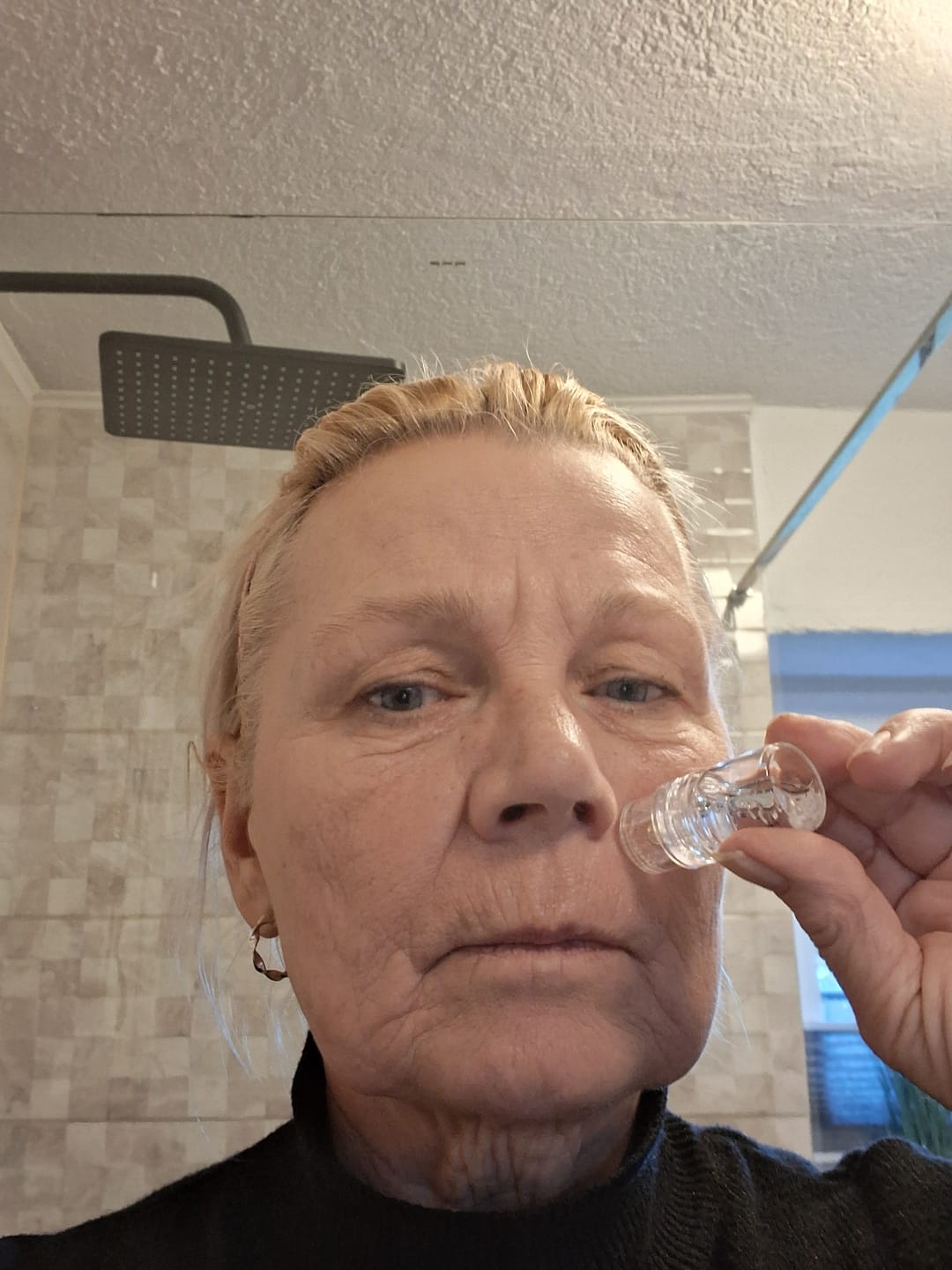 Customer photo review of Seranova Micro Infusion System™