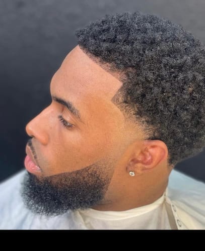 Customer photo review of Minoxidil 5% Solution, 1 Pack 60ml