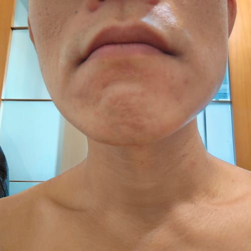 Customer photo review of Ulike Air10家用除毛儀-限時優惠