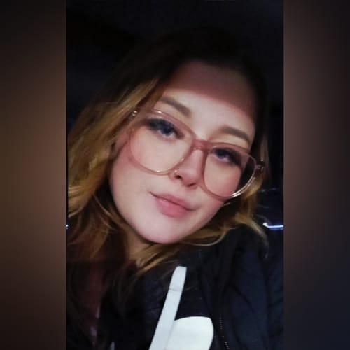 Customer photo review of Transform Wrinkles, Fine Lines, And Tired Creases Naturally