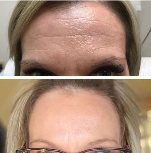 Customer photo review of TV-Set 2 I Serum + Microinfusion-System
