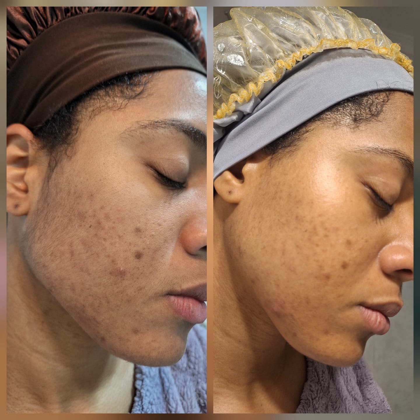 Customer photo review of A CONTROL + CORTIZEN - Equilibrio hormonal desde el cerebro, los ovarios, la piel y el metabolismo.