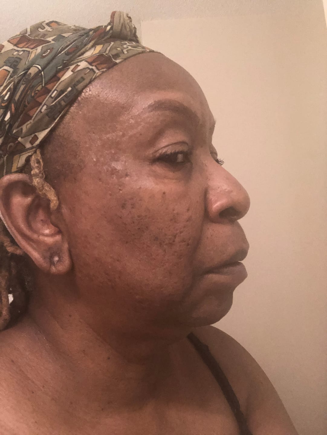 Customer photo review of Turmeric Brightening Soap (with Vitamin C, Alpha Arbutin, Oat)