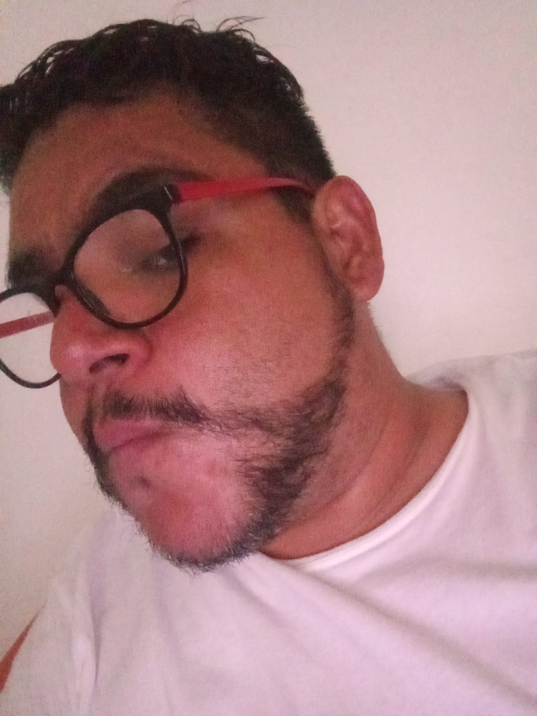 Customer photo review of Kit Barba Real | 2 Minoxidil al 20% +Biotina + Derma | El kit más Completo para crecimiento de Barba
