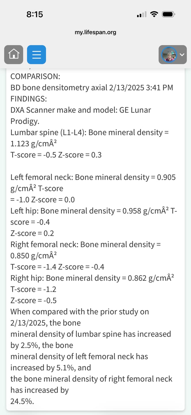 Customer photo review of Ocean Essence - Total Bone Support