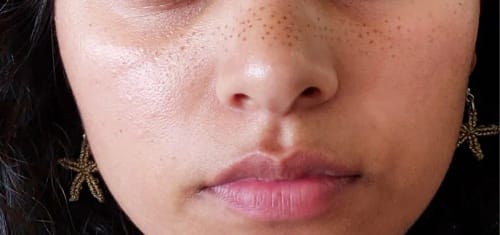 Customer photo review of Freckluxe