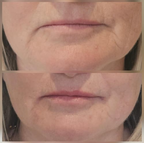 Customer photo review of TV-Set 3 I Serum + Lifting Creme